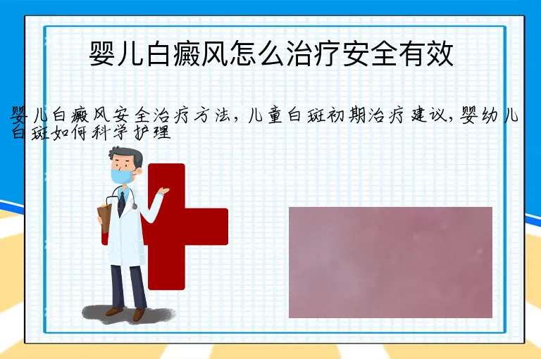 婴儿白癜风怎么治疗安全有效