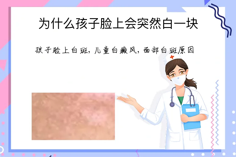 为什么孩子脸上会突然白一块