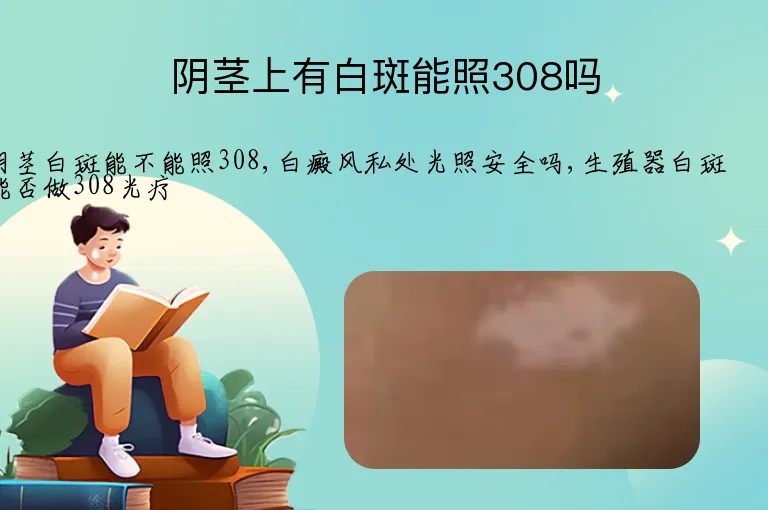 阴茎上有白斑能照308吗