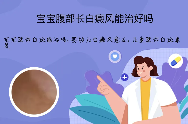 宝宝腹部长白癜风能治好吗