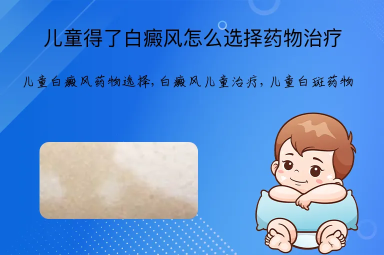 儿童得了白癜风怎么选择药物治疗
