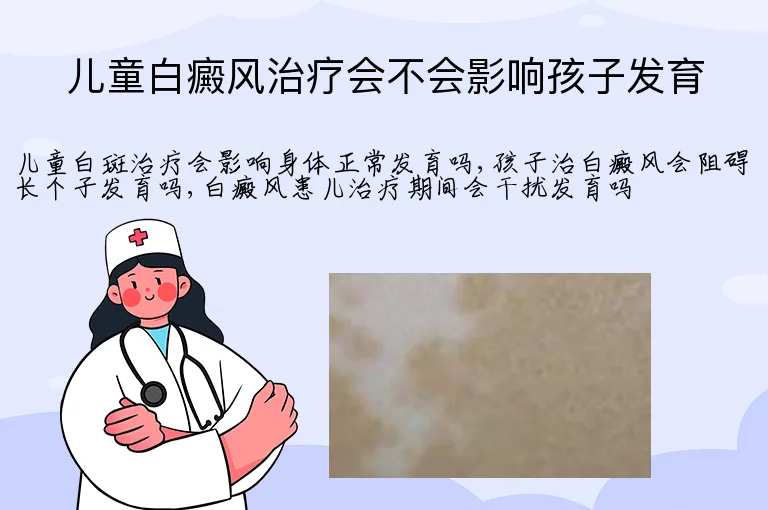 儿童白癜风治疗会不会影响孩子发育