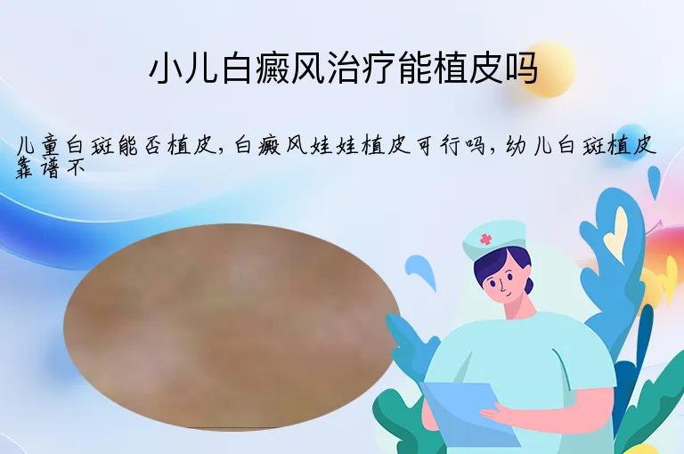 小儿白癜风治疗能植皮吗