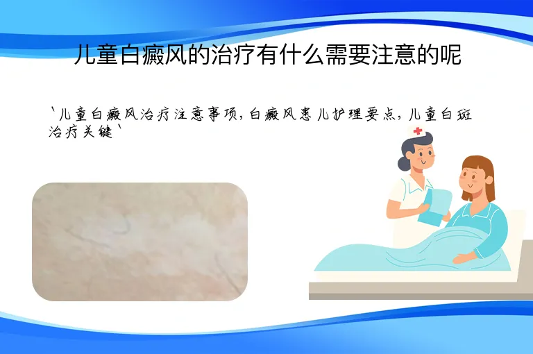 儿童白癜风的治疗有什么需要注意的呢