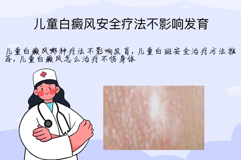 儿童白癜风安全疗法不影响发育