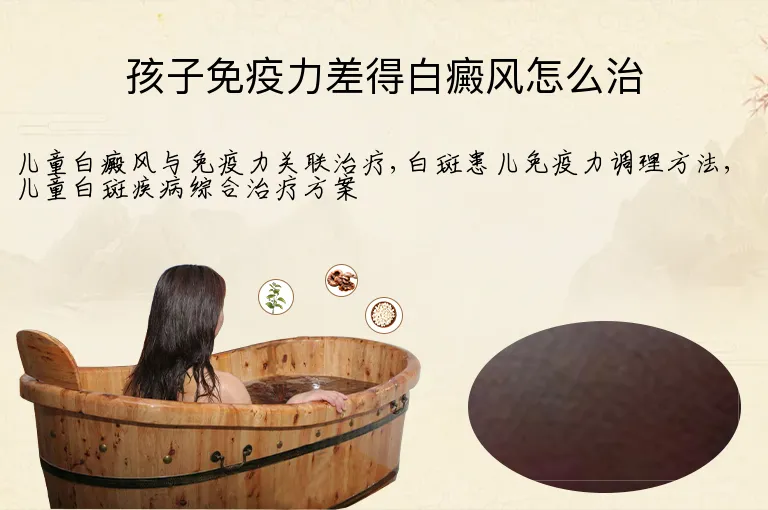 孩子免疫力差得白癜风怎么治