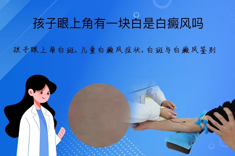 孩子眼上角有一块白是白癜风吗