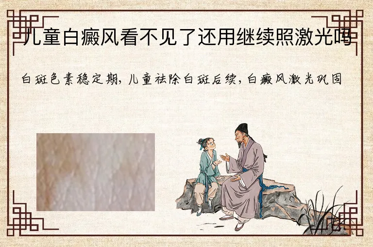 儿童白癜风看不见了还用继续照激光吗