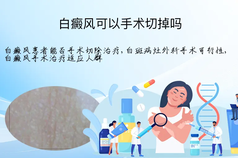 白癜风可以手术切掉吗