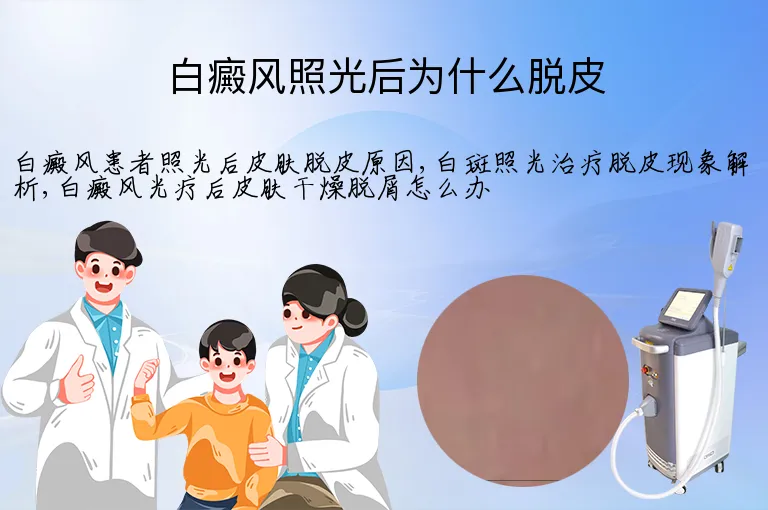 白癜风照光后为什么脱皮