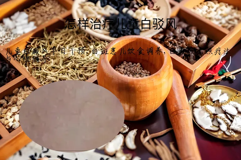 怎样治疗儿童白驳风