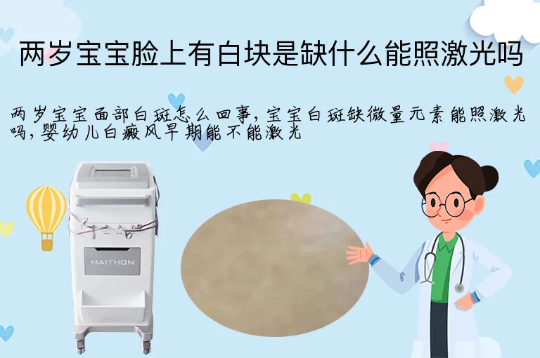 两岁宝宝脸上有白块是缺什么能照激光吗