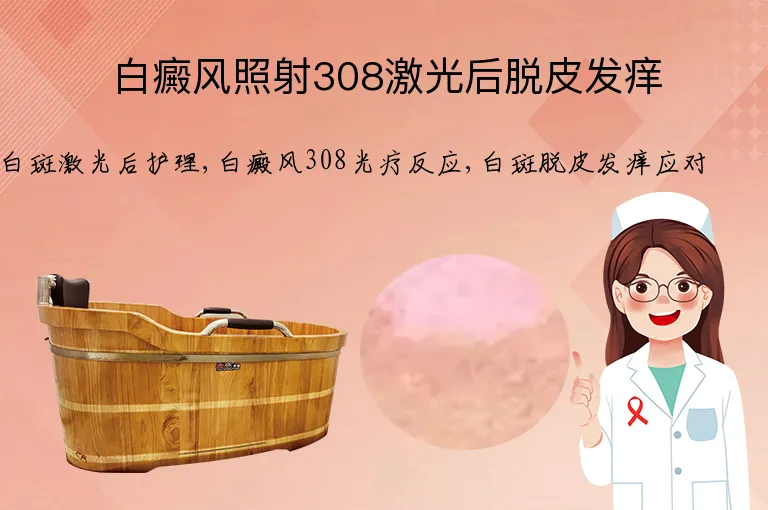 白癜风照射308激光后脱皮发痒