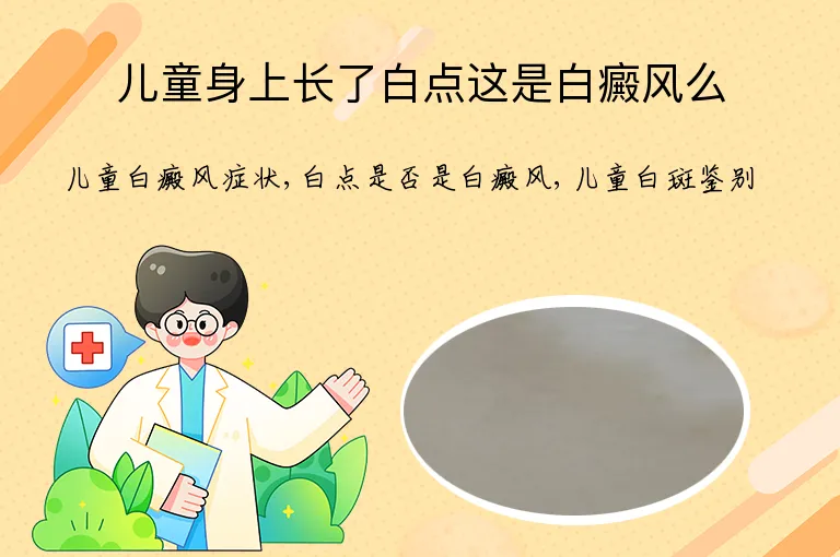儿童身上长了白点这是白癜风么