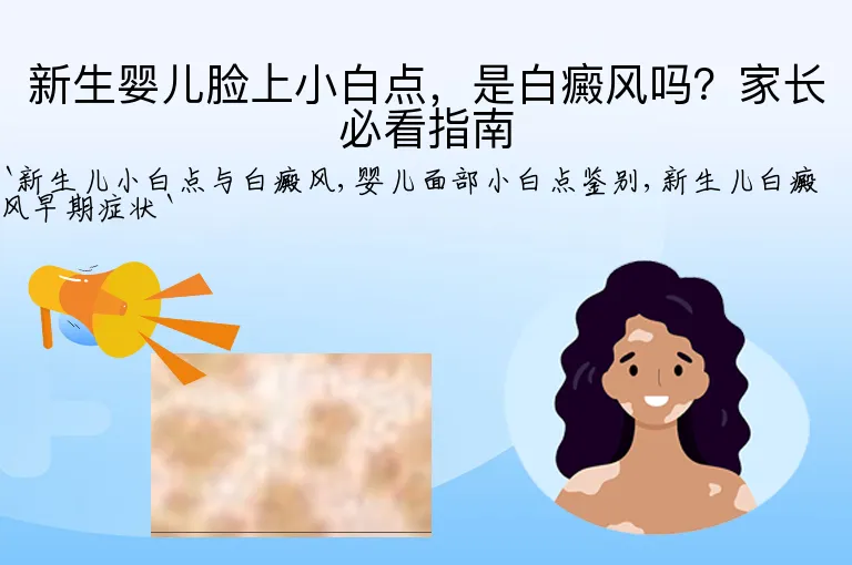 新生婴儿脸上小白点，是白癜风吗？家长必看指南