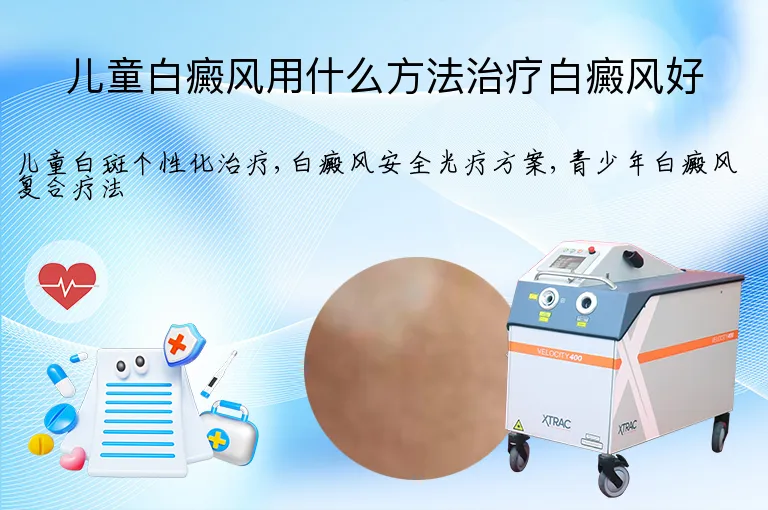 儿童白癜风用什么方法治疗白癜风好
