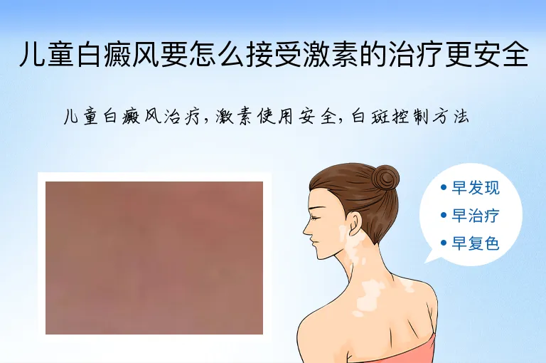 儿童白癜风要怎么接受激素的治疗更安全