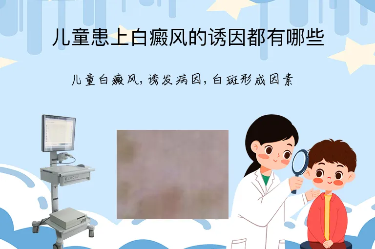儿童患上白癜风的诱因都有哪些