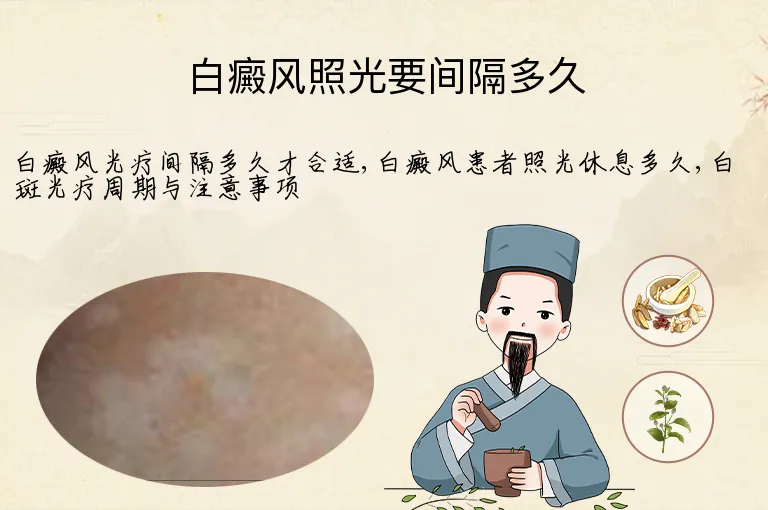 白癜风照光要间隔多久