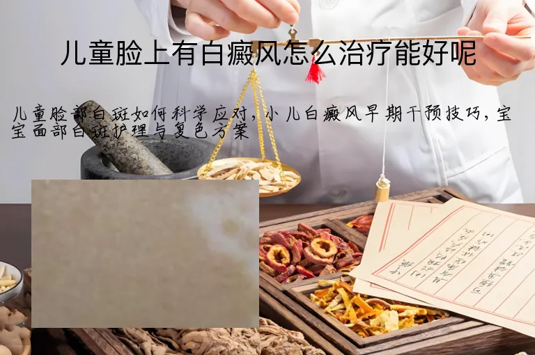 儿童脸上有白癜风怎么治疗能好呢