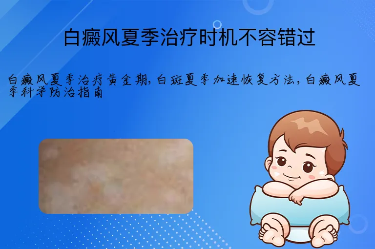 白癜风夏季治疗时机不容错过