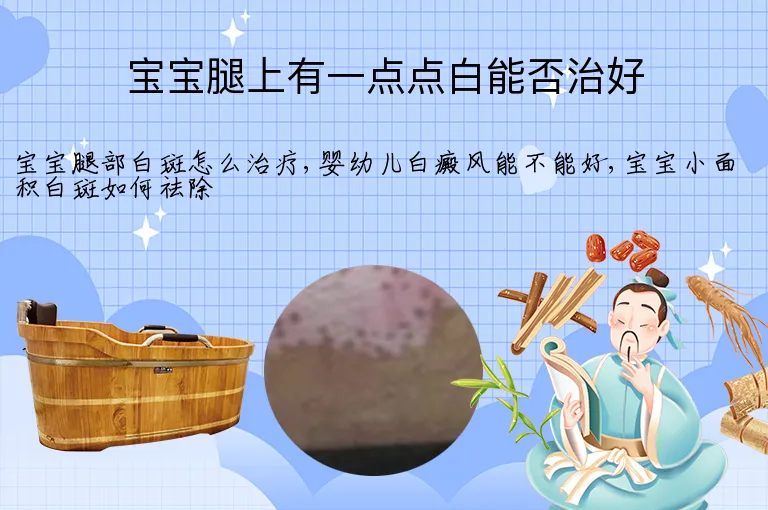 宝宝腿上有一点点白能否治好