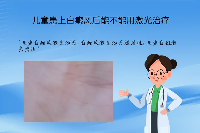 儿童患上白癜风后能不能用激光治疗