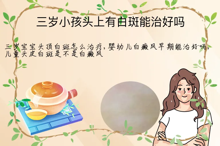 三岁小孩头上有白斑能治好吗