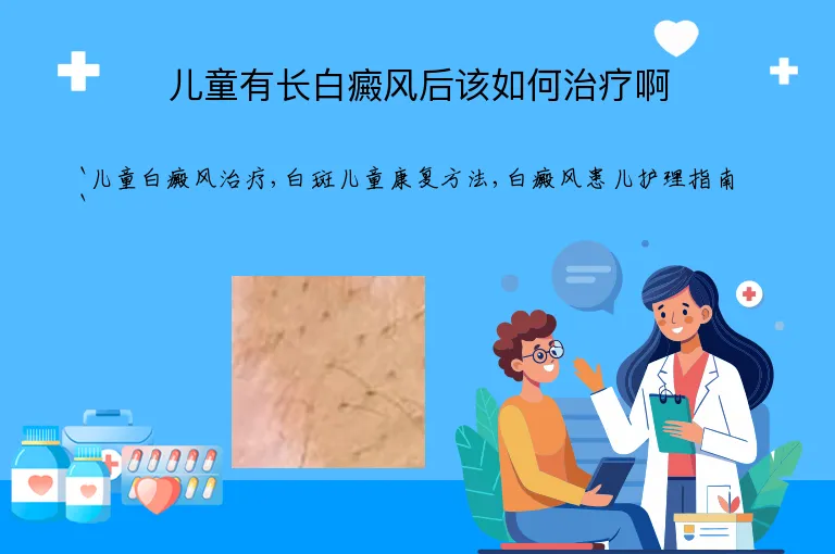 儿童有长白癜风后该如何治疗啊