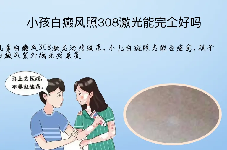 小孩白癜风照308激光能完全好吗