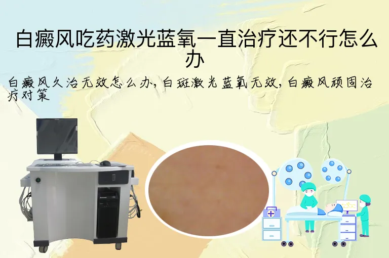白癜风吃药激光蓝氧一直治疗还不行怎么办