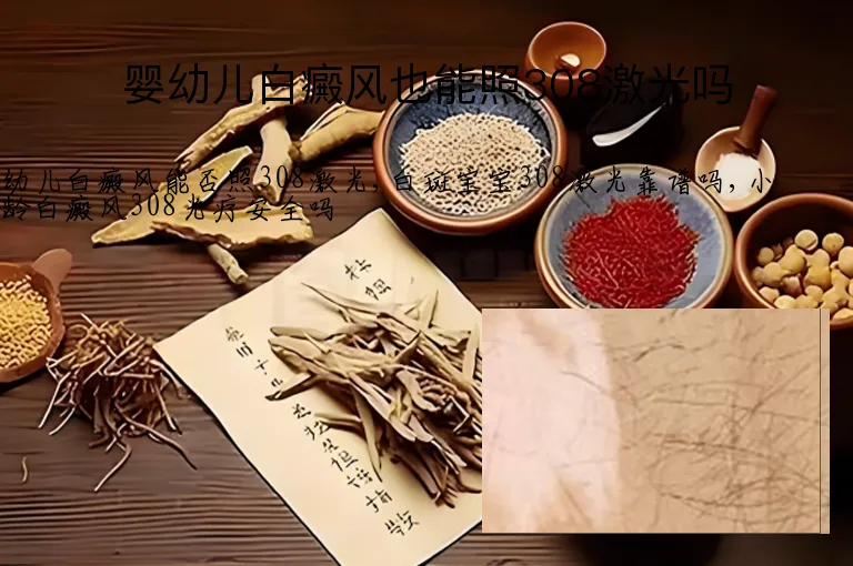 婴幼儿白癜风也能照308激光吗