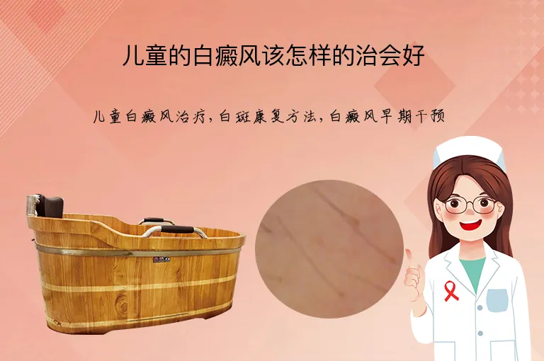 儿童的白癜风该怎样的治会好