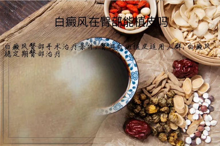 白癜风在臀部能植皮吗