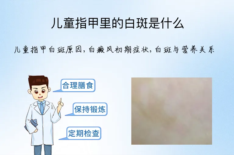 儿童指甲里的白斑是什么