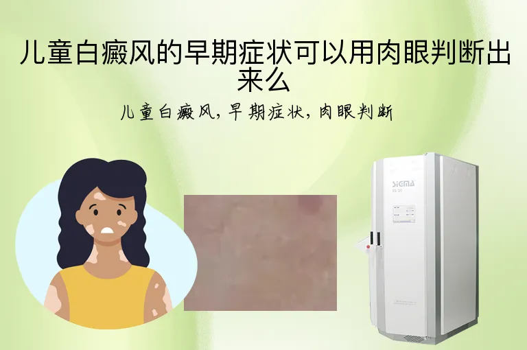 儿童白癜风的早期症状可以用肉眼判断出来么