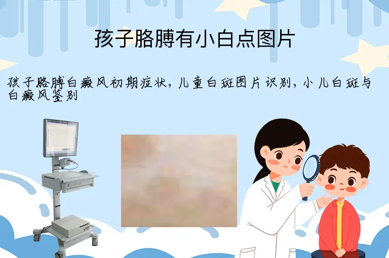 孩子胳膊有小白点图片