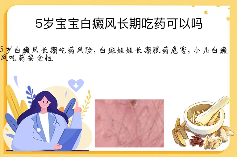 5岁宝宝白癜风长期吃药可以吗