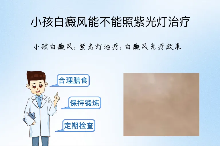 小孩白癜风能不能照紫光灯治疗