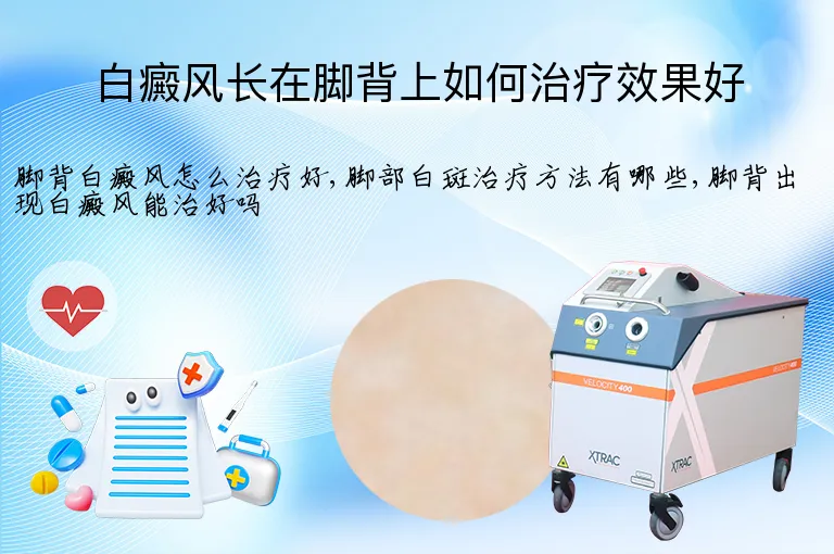 白癜风长在脚背上如何治疗效果好