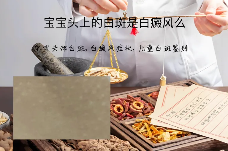 宝宝头上的白斑是白癜风么