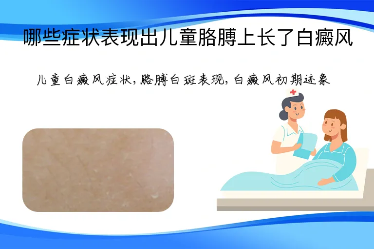 哪些症状表现出儿童胳膊上长了白癜风