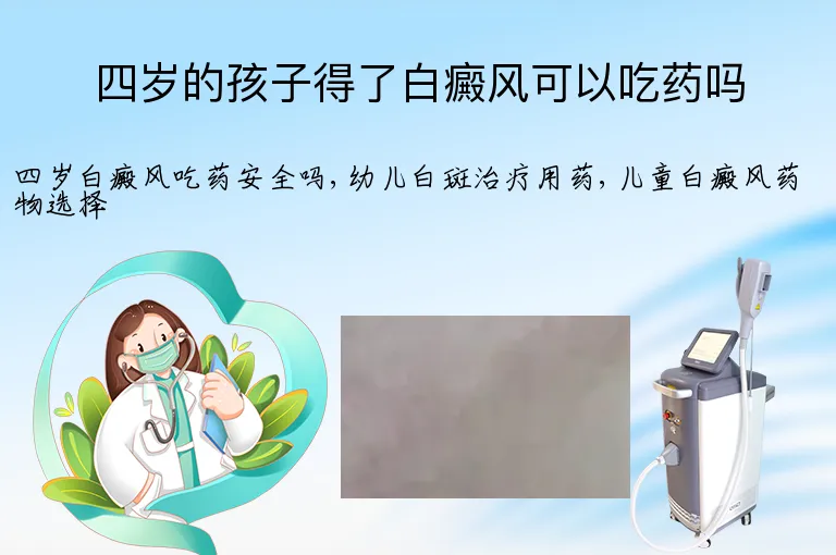 四岁的孩子得了白癜风可以吃药吗