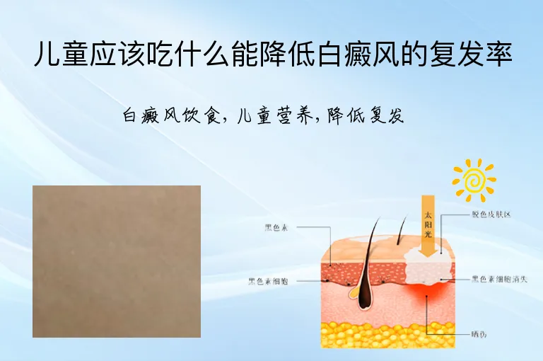 儿童应该吃什么能降低白癜风的复发率