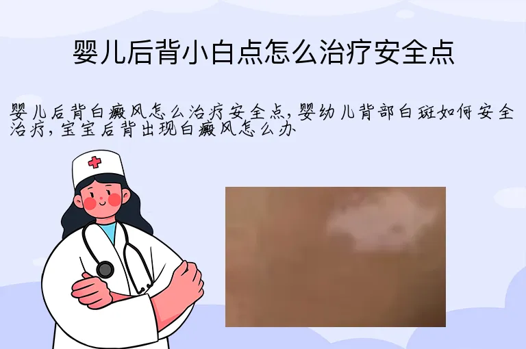 婴儿后背小白点怎么治疗安全点