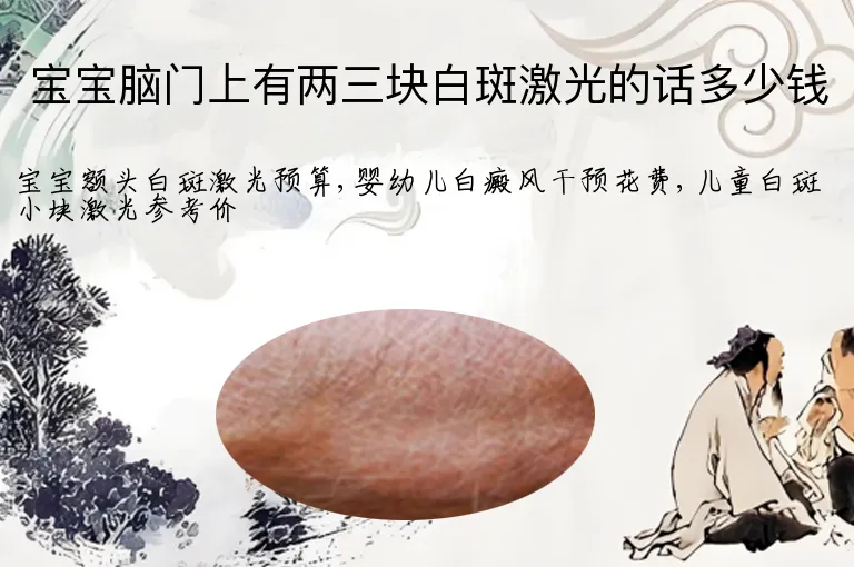宝宝脑门上有两三块白斑激光的话多少钱