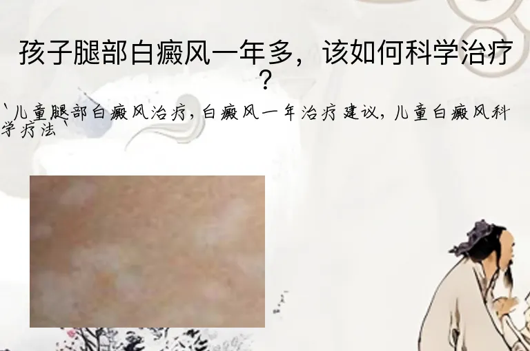 孩子腿部白癜风一年多，该如何科学治疗？