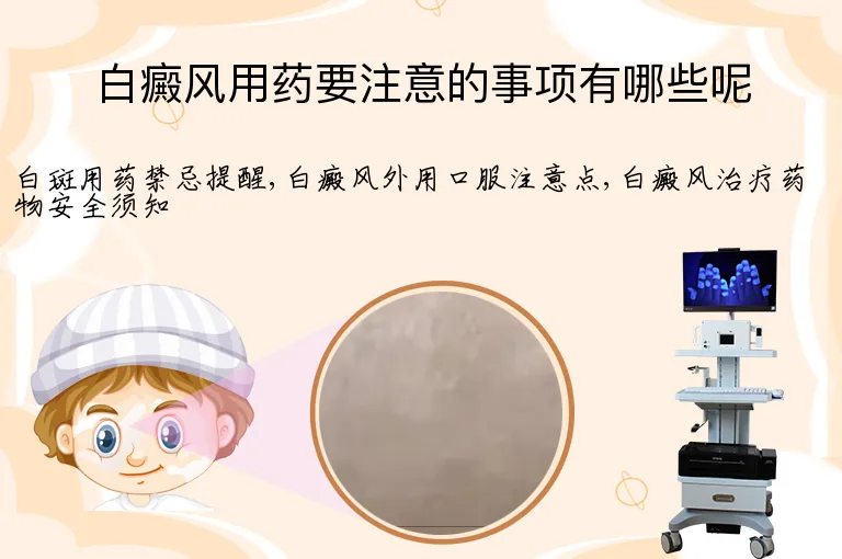 白癜风用药要注意的事项有哪些呢