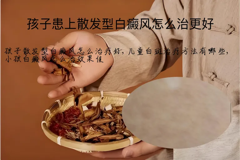 孩子患上散发型白癜风怎么治更好