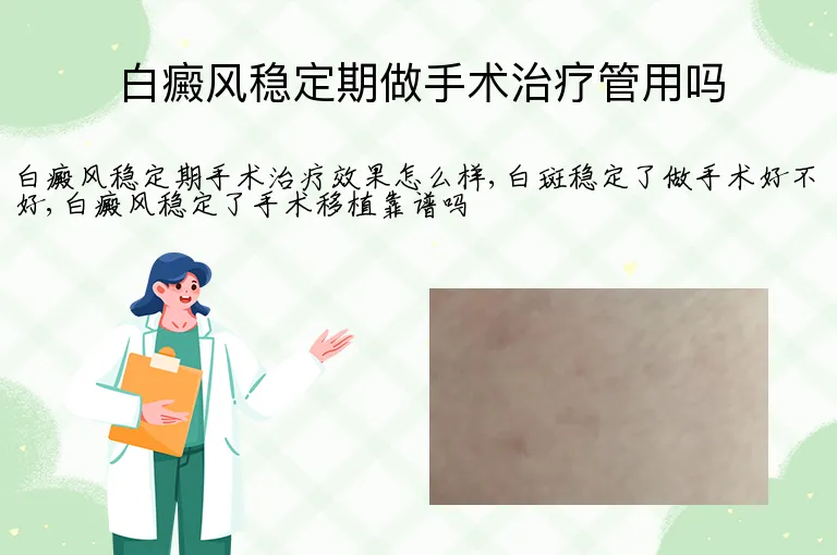 白癜风稳定期做手术治疗管用吗